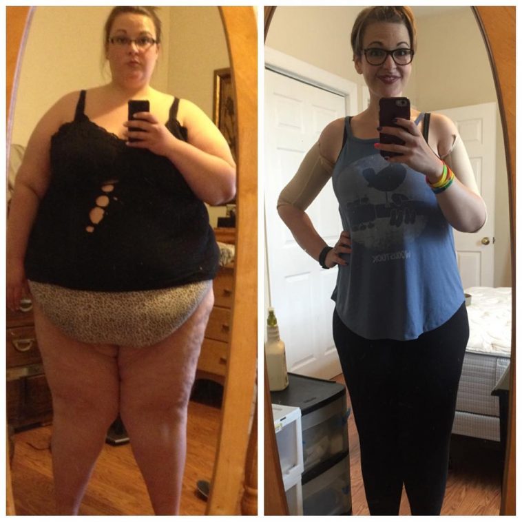 Monica Went From 475lbs & Miserable To Losing Almost 300lbs & Feeling ...