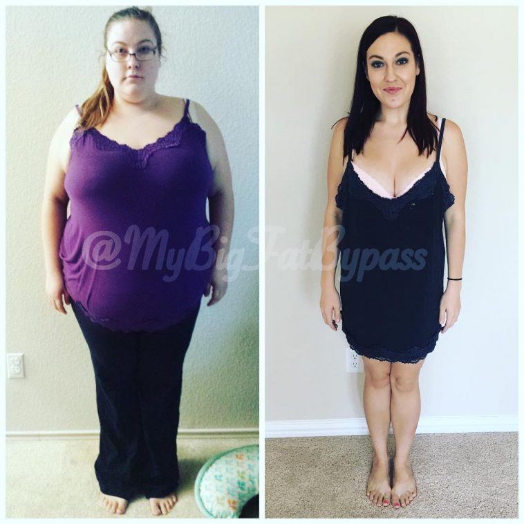 Lyndsey Hoover aka MyBigFatBypass Lost 196lbs & Now Wears A Size Zero ...