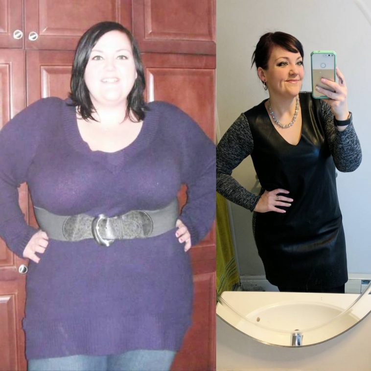 Mallory Buettner Lost 210 Pounds After Weight Loss Surgery To Finally ...