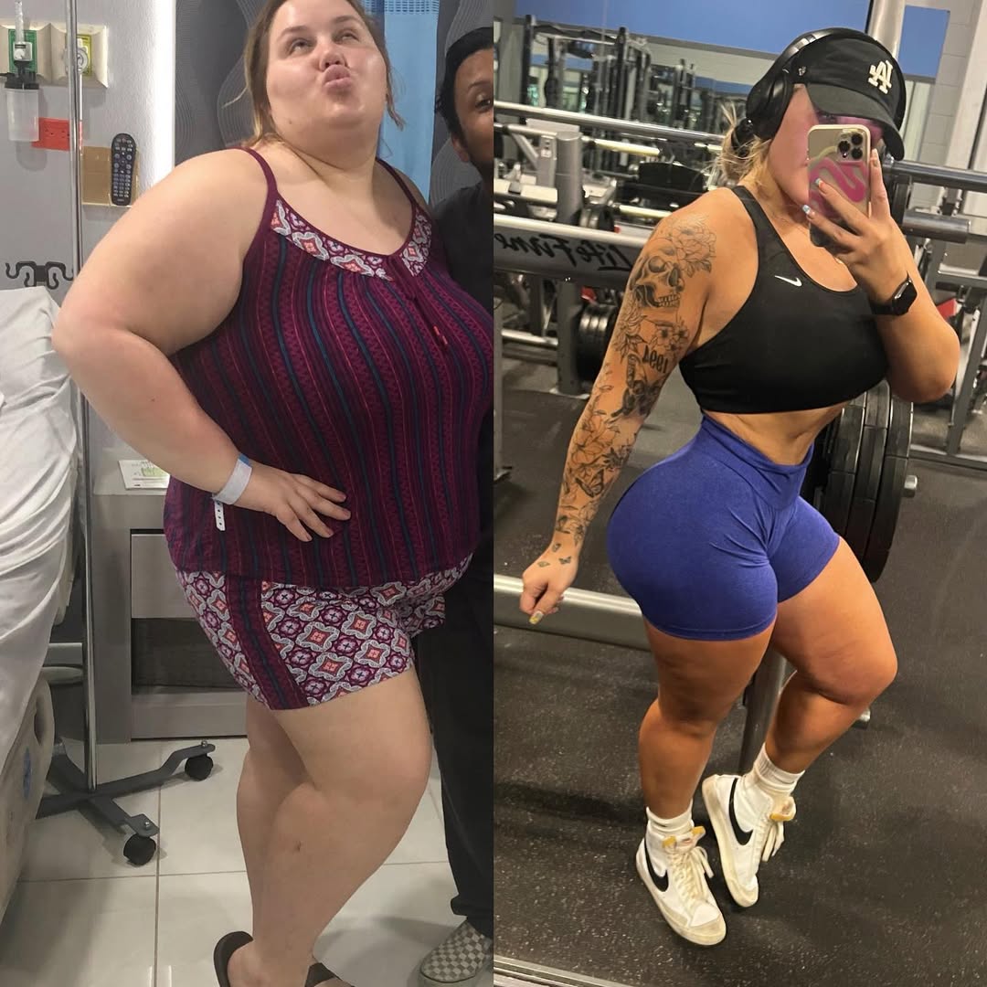 Jakelie George Weight Loss Transformation 2 3